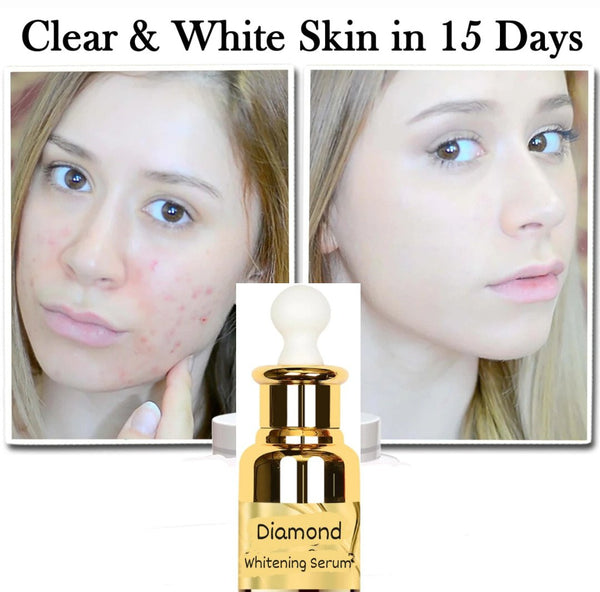 Diamond Whitening Serum