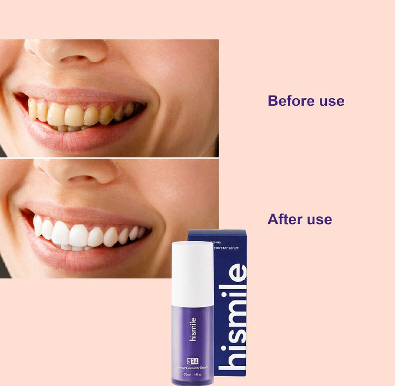 Hismile Teeth Whitening Toothpaste