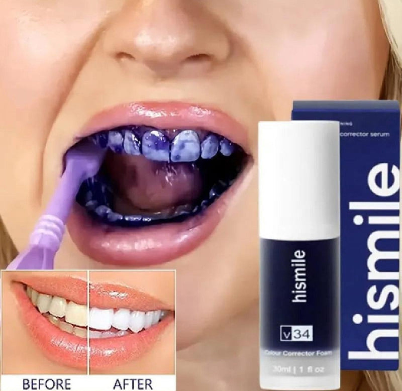 Hismile Teeth Whitening Toothpaste