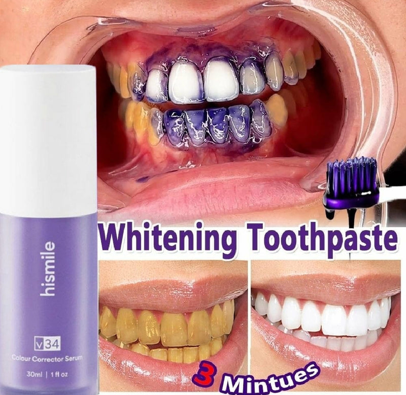 Hismile Teeth Whitening Toothpaste